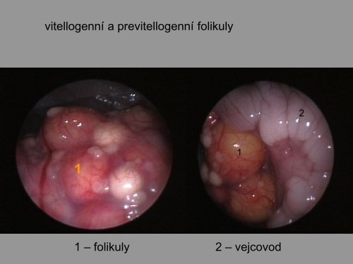 KLINICKÃ MORFOLOGIE - PLAZI