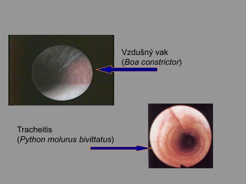 KLINICKÃ MORFOLOGIE - PLAZI