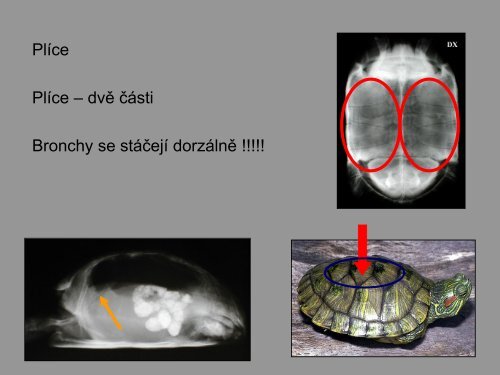 KLINICKÃ MORFOLOGIE - PLAZI