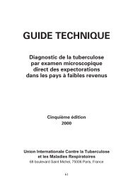 GUIDE TECHNIQUE - Tuberculosis