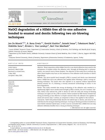 NaOCl degradation of a HEMA-free all-in-one adhesive bonded to ...