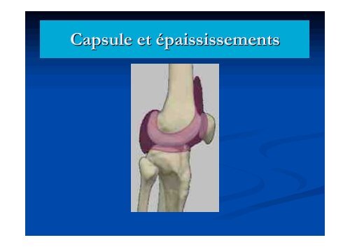 EXAMEN CLINIQUE DU GENOU - ClubOrtho.fr