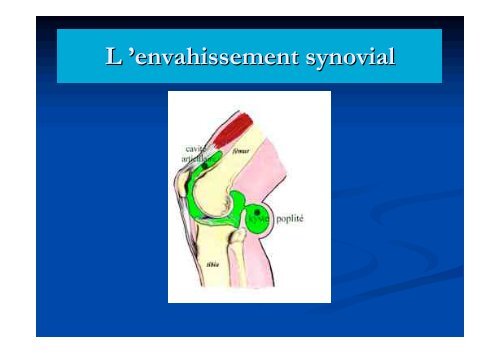 EXAMEN CLINIQUE DU GENOU - ClubOrtho.fr