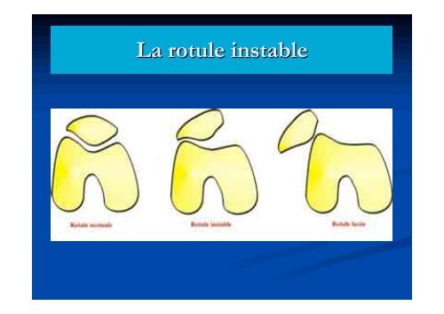 EXAMEN CLINIQUE DU GENOU - ClubOrtho.fr