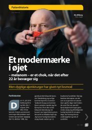 et modermærke i øjet – melanom