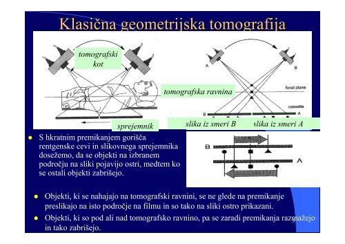 VI RaÄunalniÅ¡ka tomografija (CT) - F9