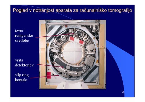 VI RaÄunalniÅ¡ka tomografija (CT) - F9