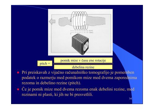 VI RaÄunalniÅ¡ka tomografija (CT) - F9