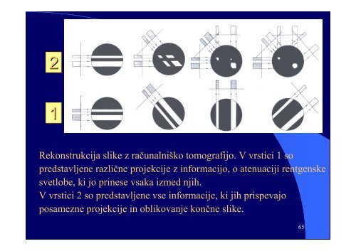 VI RaÄunalniÅ¡ka tomografija (CT) - F9