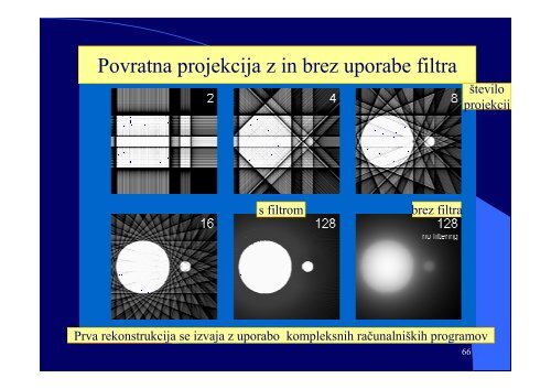 VI RaÄunalniÅ¡ka tomografija (CT) - F9