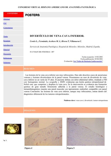 DIVERTÃCULO DE VENA CAVA INFERIOR. - V Congreso Virtual ...