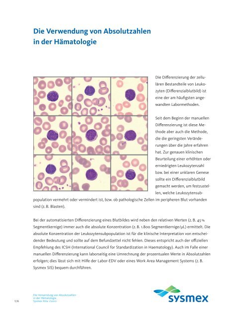 Die Verwendung von Absolutzahlen in der Hämatologie