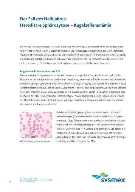 Hereditäre Sphärozytose - Sysmex Deutschland GmbH