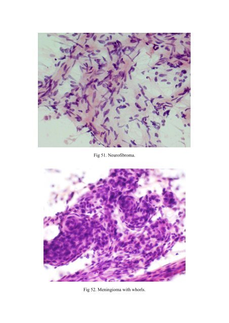 CSF/brain smear cytology - Rcpa.tv