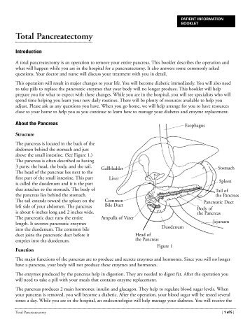 Total Pancreatectomy - Memorial Sloan-Kettering Cancer Center