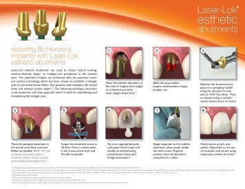 Laser-Lok esthetic abutments - BioHorizons