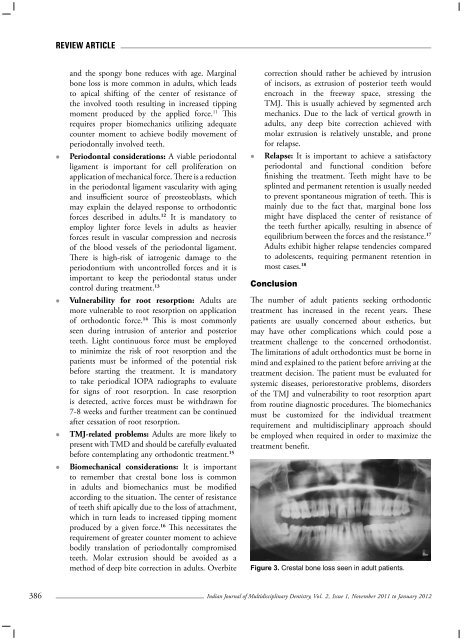 Volume 2 - Issue 1 (Nov-Jan) - IJMD