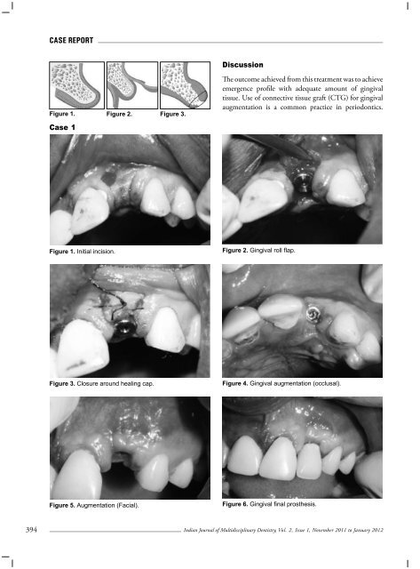 Volume 2 - Issue 1 (Nov-Jan) - IJMD