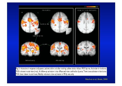 Lynette Masters Neuroradiologist