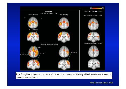 Lynette Masters Neuroradiologist