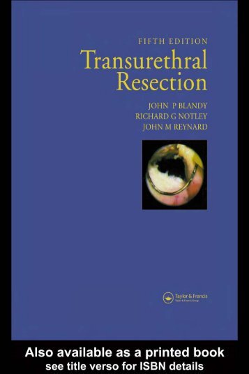 transurethral resection - British Association of Urological Surgeons