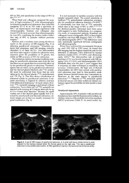 PARATHYROID AND THYROID IMAGING - Neuroradiology