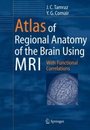 Brain MRI ATLAS