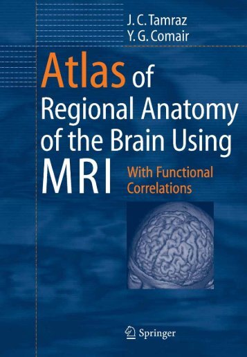 Brain MRI ATLAS