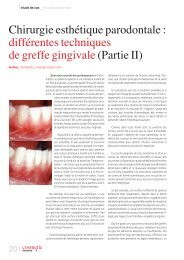 Chirurgie esthÃ©tique parodontale : diffÃ©rentes techniques de greffe ...