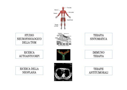 Sindrome di Lambert Eaton: diagnostica e terapia