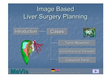 Image Based Liver Surgery Planning MeVis - UniTransferKlinik