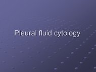Pleural fluid cytology - The Lung Center