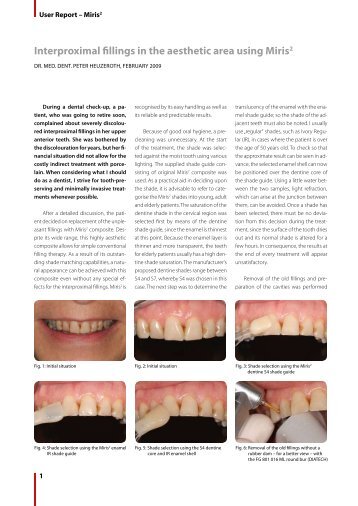 000247 AWB_Miris2_Heuzeroth_EN.pdf - Dentinal Tubules