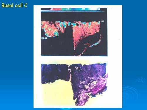 Fluorescence Lifetime Imaging Microscopy Microscopy [FLIM]