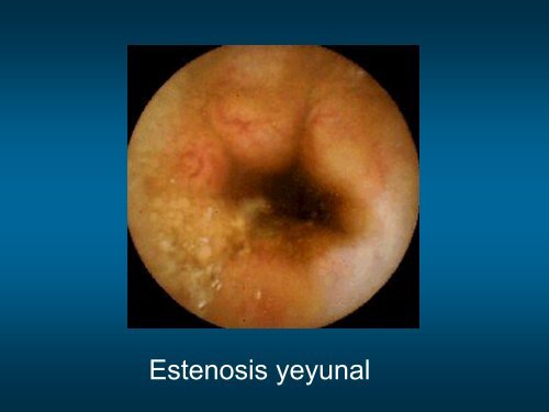 diarrea cronica 2.pdf - ClÃ­nica de GastroenterologÃ­a.