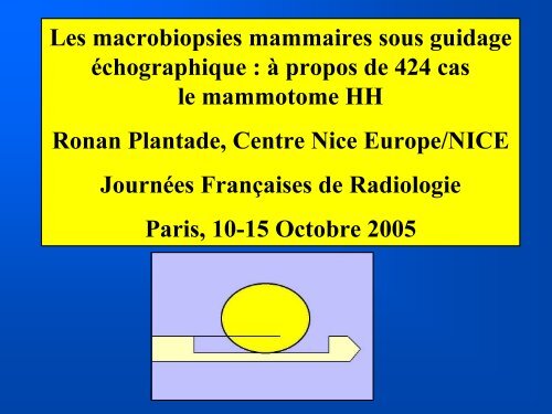 Les macrobiopsies mammaires sous guidage Ã©chographique : Ã  ...