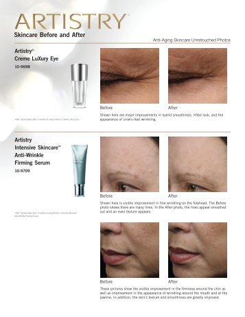 Skincare Before and After ARTISTRYÂ® Creme LuXury Eye ... - Amway