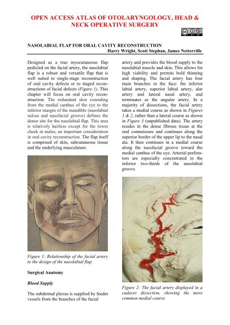 Nasolabial flap for oral cavity reconstruction - Vula - University of ...