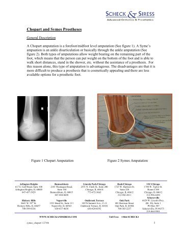 Symes and Chopart Prostheses - Scheck & Siress