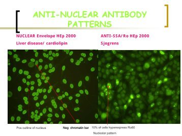 anti-nuclear antibody patterns - Rcpa.tv