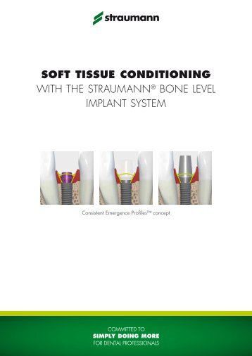 Soft tissue conditioning with the Straumann Â® Bone level implant ...