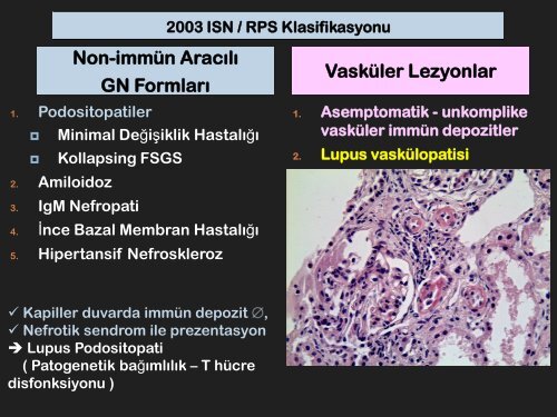 Klas V: MembranÃ¶z Lupus Nefriti