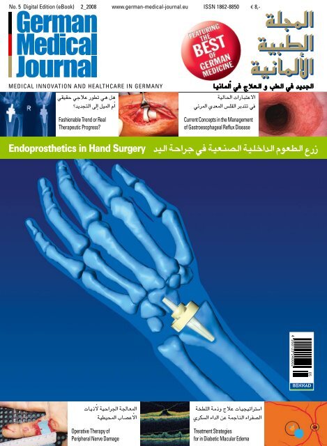 Ø²Ø±Ø¹ Ø§Ù„Ø·Ø¹ÙˆÙ… Ø§Ù„Ø¯Ø§Ø®Ù„ÙŠØ© Ø§Ù„ØµÙ†Ø¹ÙŠØ©ÙŠÙ Ø¬Ø±Ø§Ø­Ø© Ø§Ù„ÙŠØ¯ Endoprosthetics In Hand