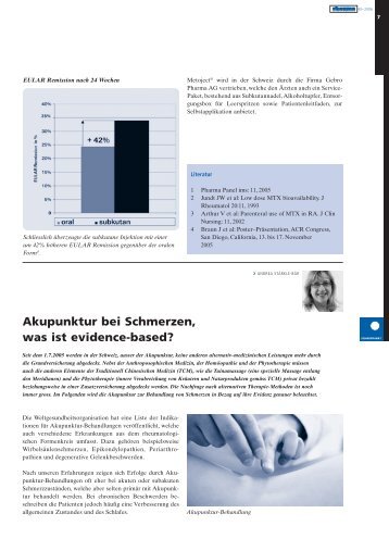 Akupunktur bei Schmerzen,  was ist evidence ... - Rheuma Schweiz