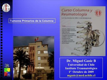 Tumores primarios columna