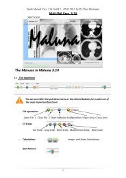 MALUNA Vers. 3.14 - ZARI