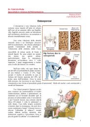 Osteoporosi - Dieta della salute - Dott. Fabrizio MODA