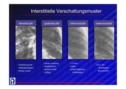 Azinäres Verschattungsmu