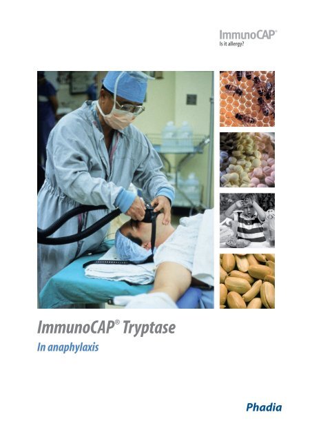 ImmunoCAPÂ® Tryptase - Phadia