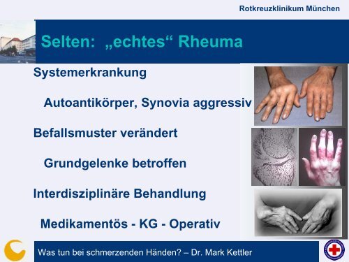 Was tun bei schmerzenden Händen? - Rotkreuzklinikum München